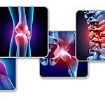 طویل عرصے تک جسم کو حرکت نہ دینے اور خون کے لوتھڑے بننے (Venous Thromboembolism) کے درمیان تعلق: نئی تحقیق