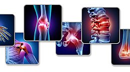 طویل عرصے تک جسم کو حرکت نہ دینے اور خون کے لوتھڑے بننے (Venous Thromboembolism) کے درمیان تعلق: نئی تحقیق