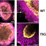 Bioprinting Advances Reshape Organoid, Tissue Research