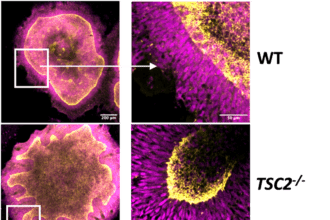 Bioprinting Advances Reshape Organoid, Tissue Research