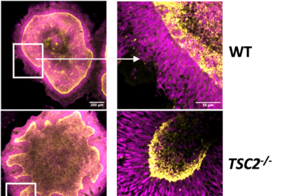 Bioprinting Advances Reshape Organoid, Tissue Research
