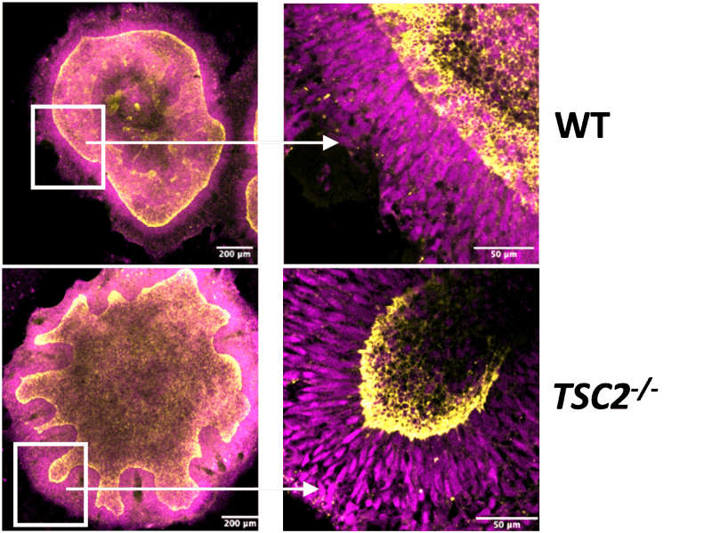 Bioprinting Advances Reshape Organoid, Tissue Research