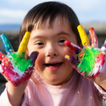 Researchers Explore Gene-Editing Breakthrough as Potential Down Syndrome Treatment