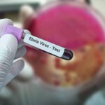 Experimental Ebola Treatment