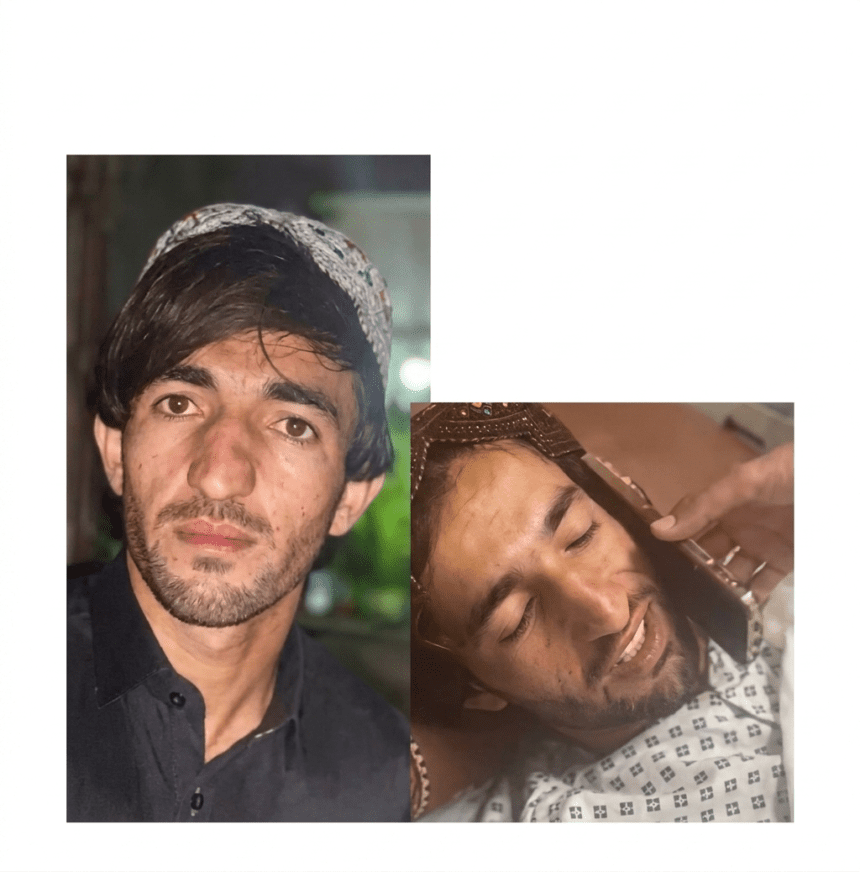 Quetta Acid Attack: CM Balochistan and Aseefa Bhutto Nominate Brave Hospital Worker for Civil Award After Rescuing Female Doctor
