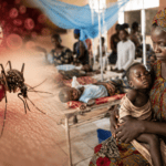 DRC Reports 26 Million Malaria Cases in 2025