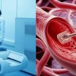 Functional Angiography Cuts Heart Risks in STEMI Patients