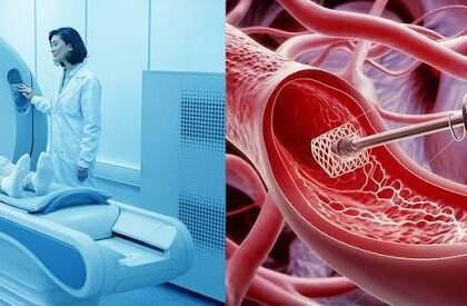Functional Angiography Cuts Heart Risks in STEMI Patients