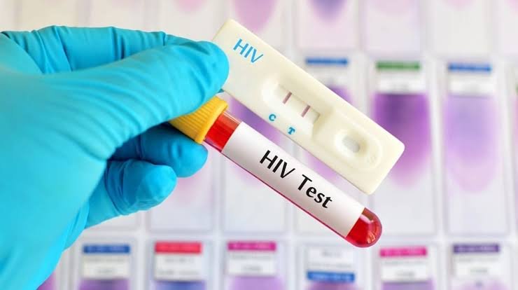 HIV Screening Made Mandatory Before Surgeries