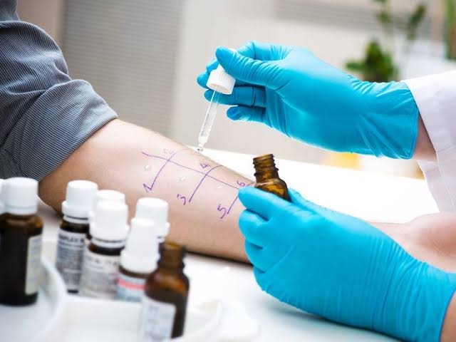 How to Choose from the 5 Best At-Home Allergy Tests