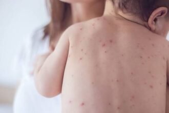 Bangladesh Measles Outbreak Leaves Nearly 1,000 Families Mourning