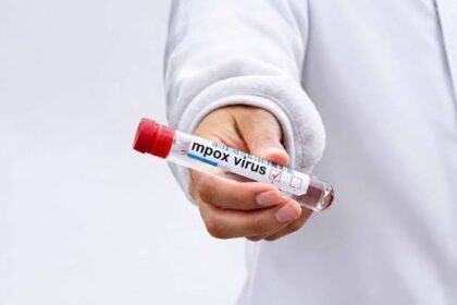 Karachi Reports Three New Mpox Cases