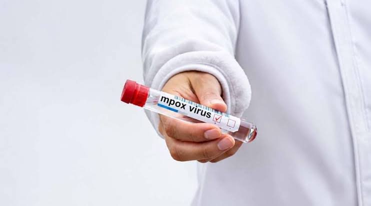 Karachi Reports Three New Mpox Cases